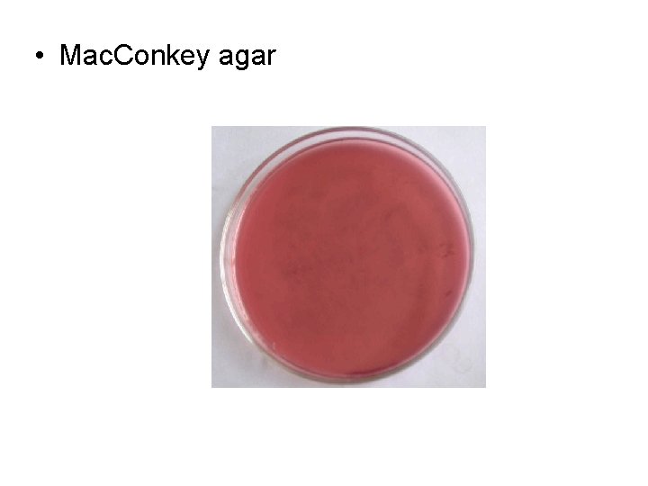 • Mac. Conkey agar • Mac. Conkey agar