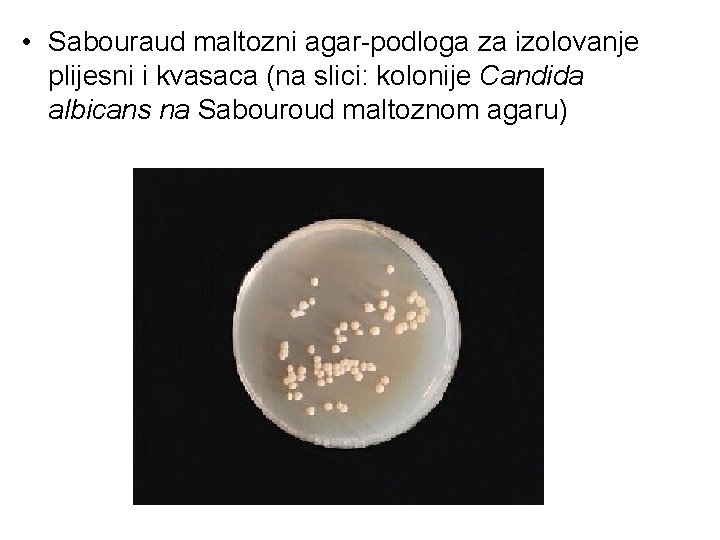 • Sabouraud maltozni agar-podloga za izolovanje plijesni i kvasaca (na slici: kolonije Candida • Sabouraud maltozni agar-podloga za izolovanje plijesni i kvasaca (na slici: kolonije Candida