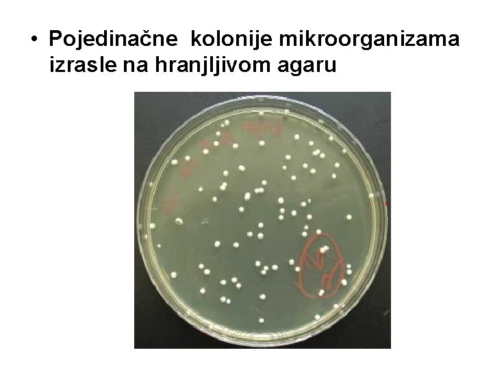• Pojedinačne kolonije mikroorganizama izrasle na hranjljivom agaru • Pojedinačne kolonije mikroorganizama izrasle na hranjljivom agaru