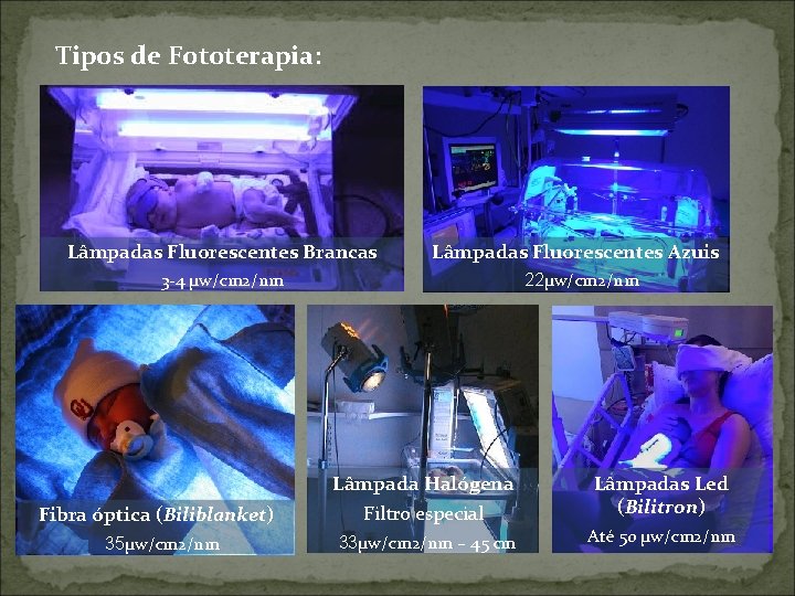 Tipos de Fototerapia: Lâmpadas Fluorescentes Brancas Lâmpadas Fluorescentes Azuis 3 -4 μw/cm 2/nm 22μw/cm