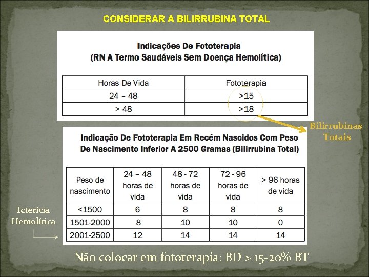 CONSIDERAR A BILIRRUBINA TOTAL Bilirrubinas Totais Icterícia Hemolítica Não colocar em fototerapia: BD >