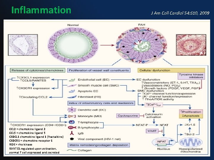 Inflammation CCL 2 = chemokine ligand 2 CCL 5 = chemokine ligand 5 CX