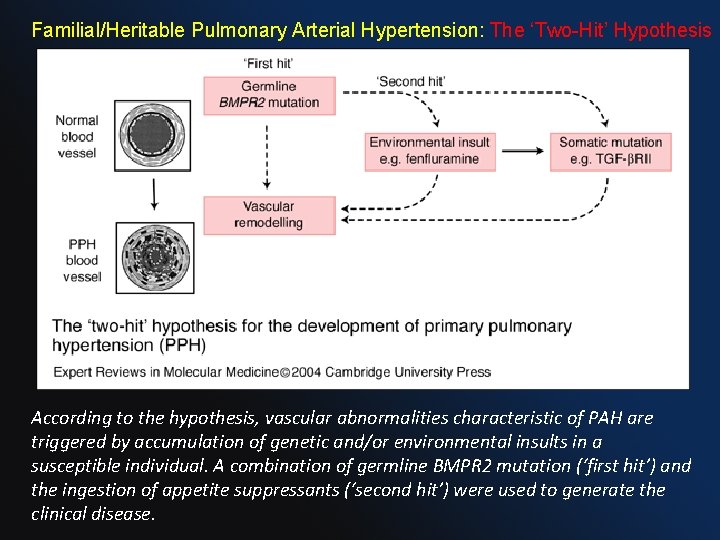 Familial/Heritable Pulmonary Arterial Hypertension: The ‘Two-Hit’ Hypothesis According to the hypothesis, vascular abnormalities characteristic Familial/Heritable Pulmonary Arterial Hypertension: The ‘Two-Hit’ Hypothesis According to the hypothesis, vascular abnormalities characteristic