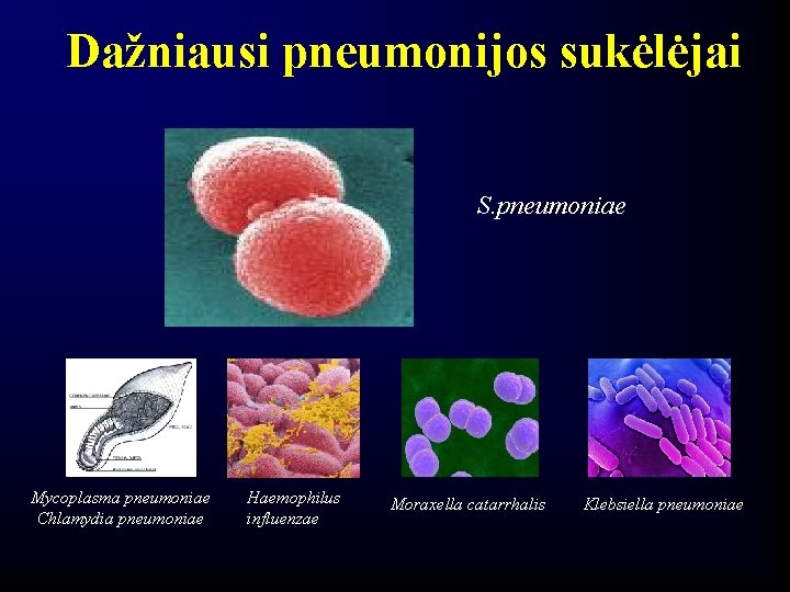 Dažniausi pneumonijos sukėlėjai S. pneumoniae Mycoplasma pneumoniae Chlamydia pneumoniae Haemophilus influenzae Moraxella catarrhalis Klebsiella