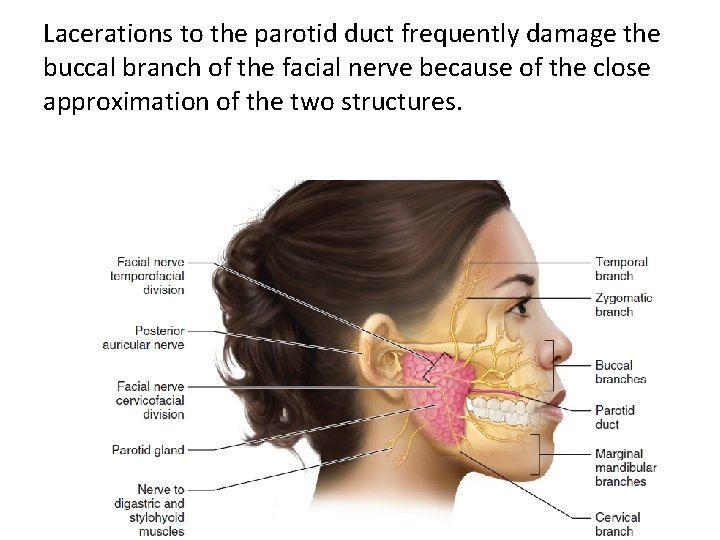 Lacerations to the parotid duct frequently damage the buccal branch of the facial nerve