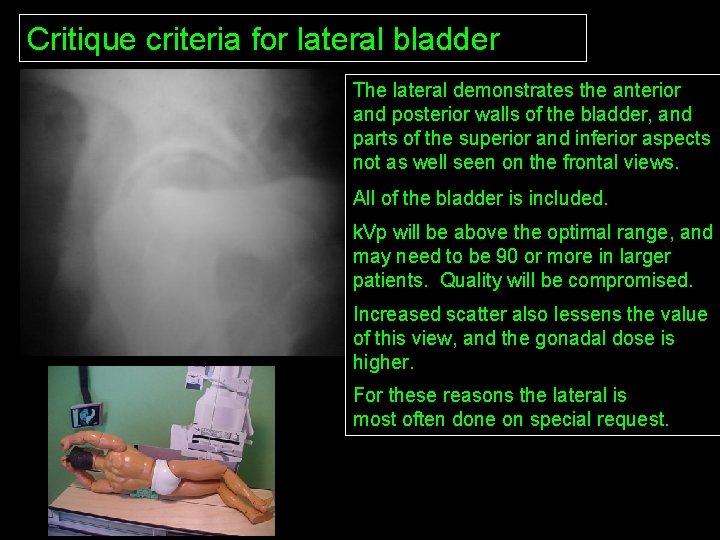 Critique criteria for lateral bladder The lateral demonstrates the anterior and posterior walls of