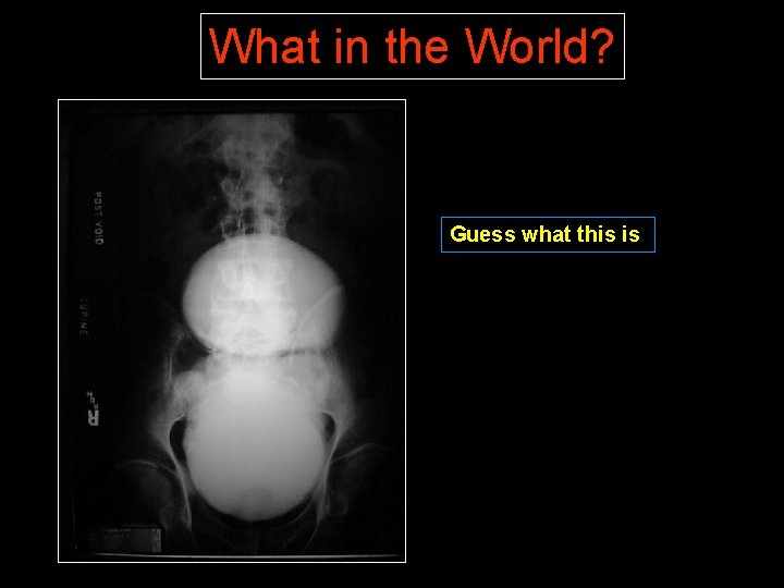 What in the World? Guess what this is 