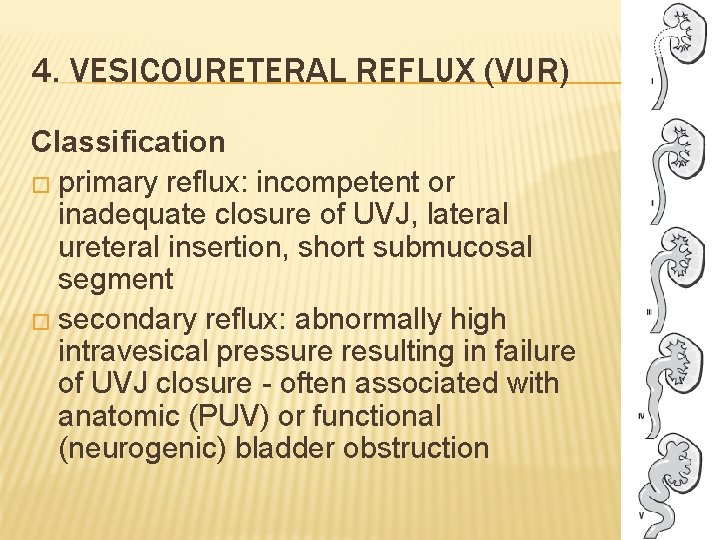 4. VESICOURETERAL REFLUX (VUR) Classification � primary reflux: incompetent or inadequate closure of UVJ,