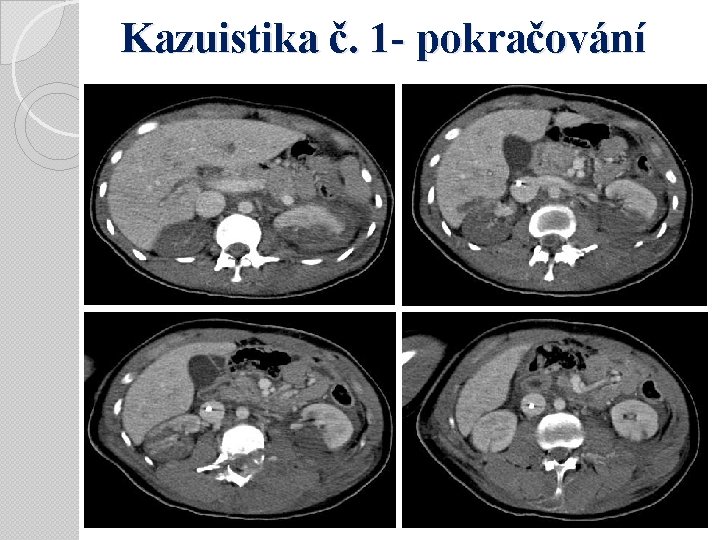 Kazuistika č. 1 - pokračování 