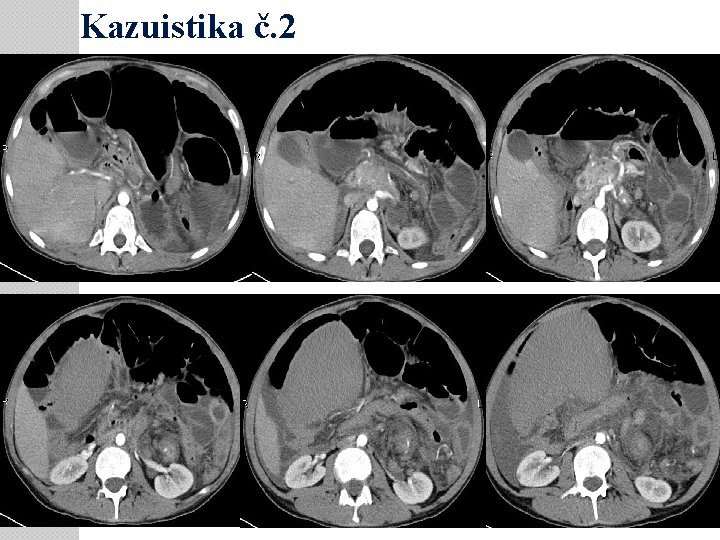 Kazuistika č. 2 