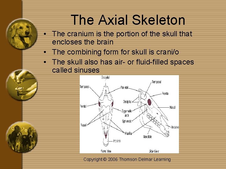 The Axial Skeleton • The cranium is the portion of the skull that encloses