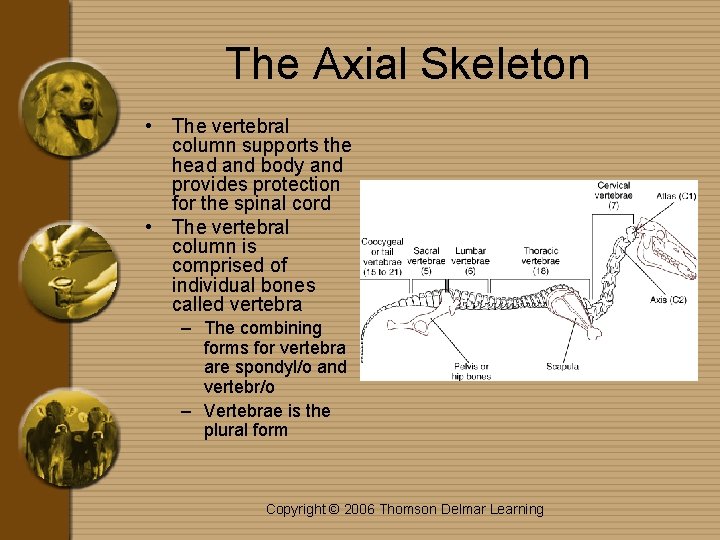 The Axial Skeleton • The vertebral column supports the head and body and provides