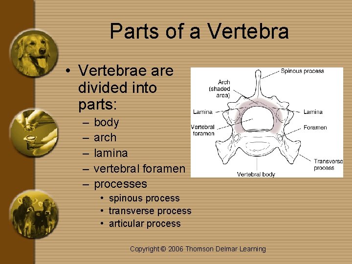 Parts of a Vertebra • Vertebrae are divided into parts: – – – body