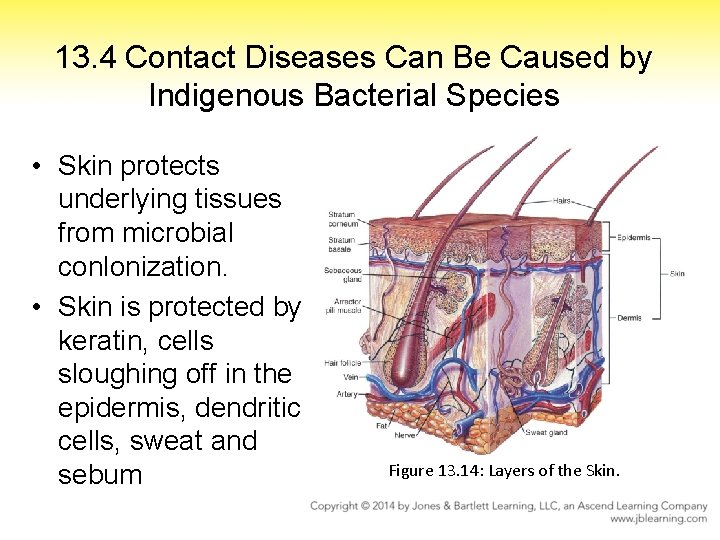 13. 4 Contact Diseases Can Be Caused by Indigenous Bacterial Species • Skin protects