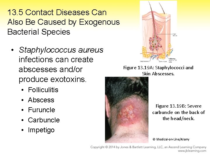 13. 5 Contact Diseases Can Also Be Caused by Exogenous Bacterial Species • Staphylococcus