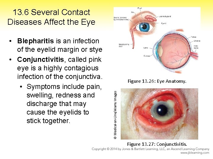 13. 6 Several Contact Diseases Affect the Eye Figure 13. 26: Eye Anatomy. ©