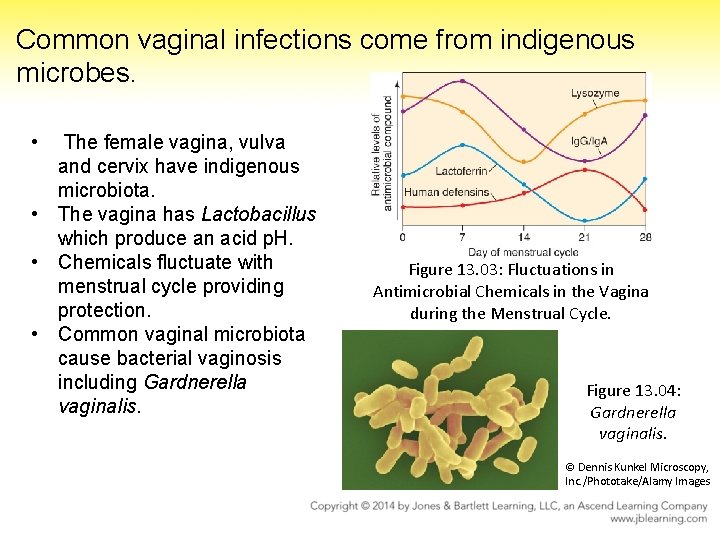 Common vaginal infections come from indigenous microbes. • The female vagina, vulva and cervix