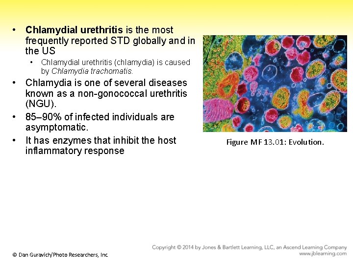  • Chlamydial urethritis is the most frequently reported STD globally and in the