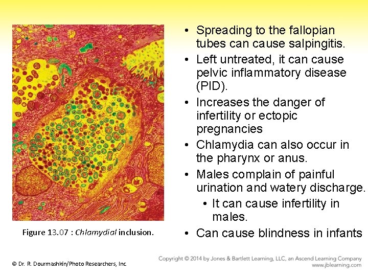 Figure 13. 07 : Chlamydial inclusion. © Dr. R. Dourmashkin/Photo Researchers, Inc. • Spreading