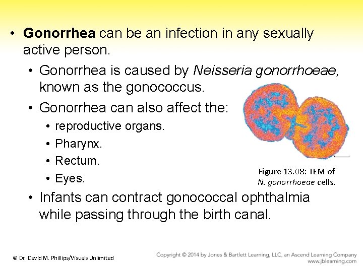  • Gonorrhea can be an infection in any sexually active person. • Gonorrhea