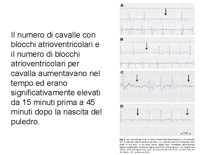 Il numero di cavalle con blocchi atrioventricolari e il numero di blocchi atrioventricolari per