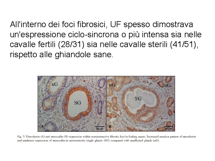 All'interno dei foci fibrosici, UF spesso dimostrava un'espressione ciclo-sincrona o più intensa sia nelle