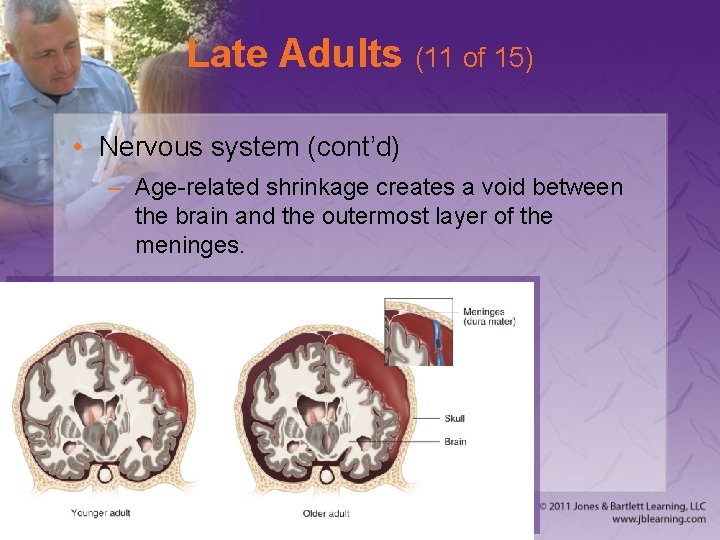 Late Adults (11 of 15) • Nervous system (cont’d) – Age-related shrinkage creates a