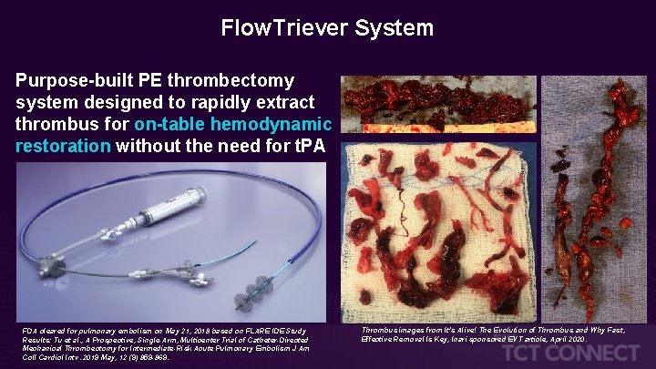 Flow. Triever System Purpose-built PE thrombectomy system designed to rapidly extract thrombus for on-table