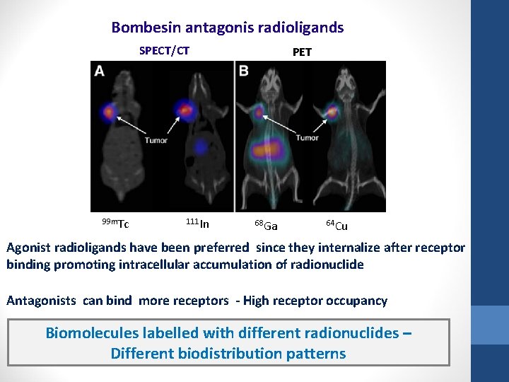 Bombesin antagonis radioligands SPECT/CT 99 m. Tc 111 In PET 68 Ga 64 Cu