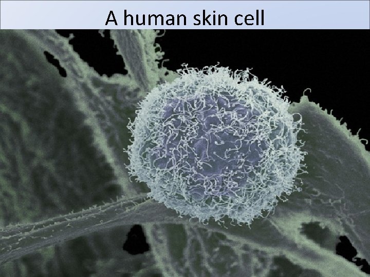 A human skin cell 