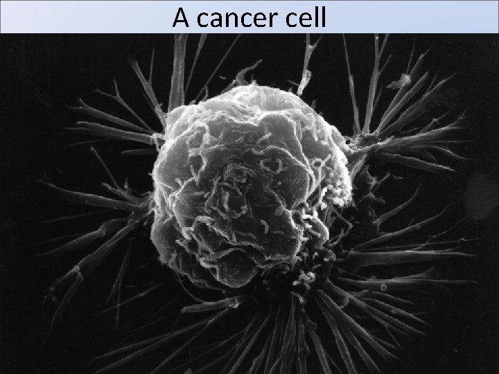 A cancer cell 