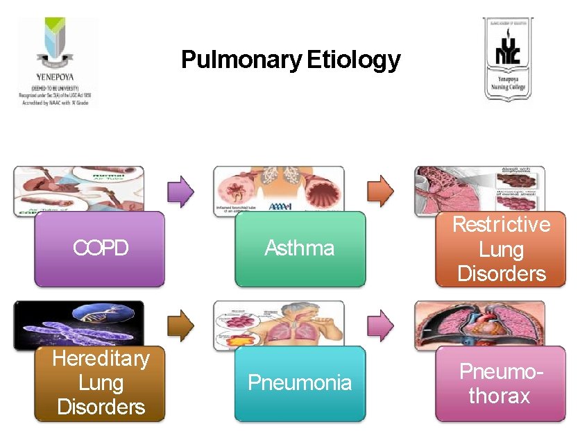 Pulmonary Etiology COPD Hereditary Lung Disorders Asthma Restrictive Lung Disorders Pneumonia Pneumo- thorax 