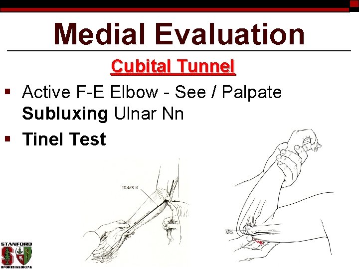 Medial Evaluation Cubital Tunnel § Active F-E Elbow - See / Palpate Subluxing Ulnar