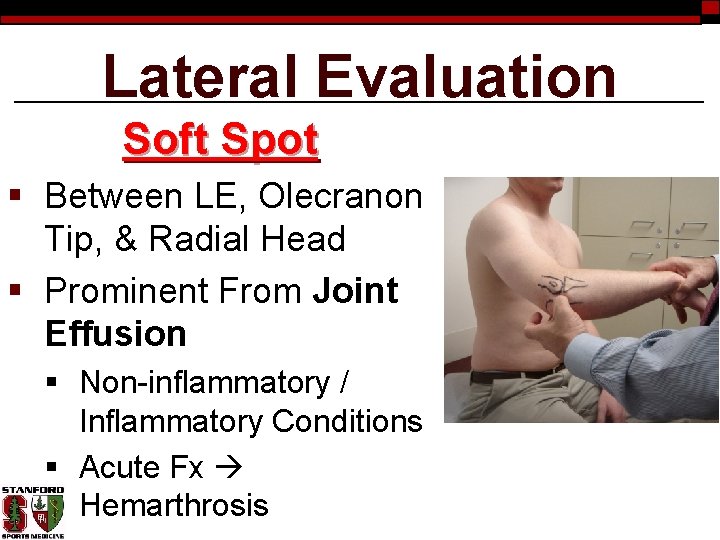 Lateral Evaluation Soft Spot § Between LE, Olecranon Tip, & Radial Head § Prominent