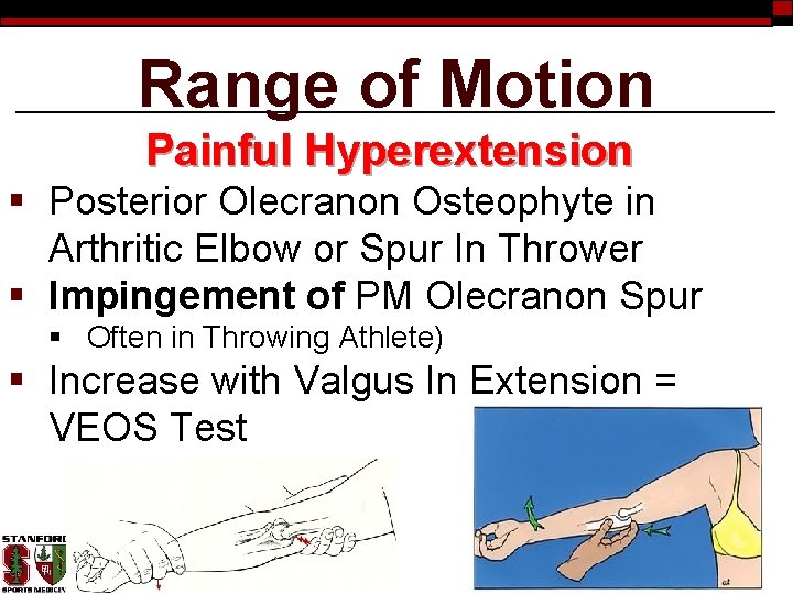 Range of Motion Painful Hyperextension § Posterior Olecranon Osteophyte in Arthritic Elbow or Spur