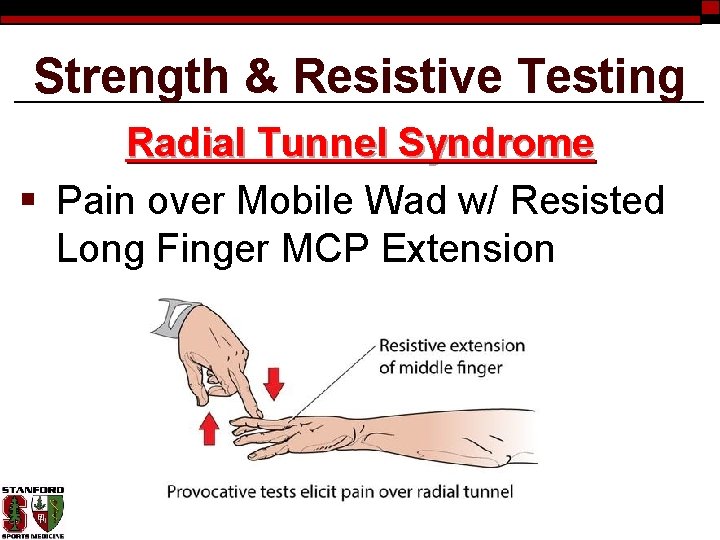 Strength & Resistive Testing Radial Tunnel Syndrome § Pain over Mobile Wad w/ Resisted