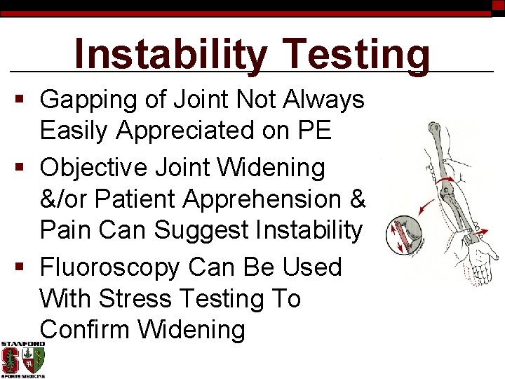 Instability Testing § Gapping of Joint Not Always Easily Appreciated on PE § Objective