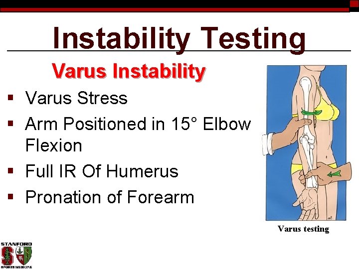 Instability Testing Varus Instability § Varus Stress § Arm Positioned in 15° Elbow Flexion