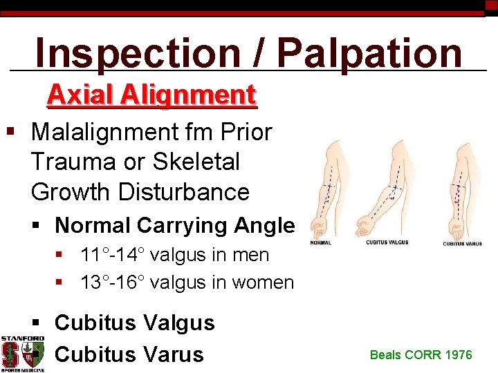 Inspection / Palpation Axial Alignment § Malalignment fm Prior Trauma or Skeletal Growth Disturbance