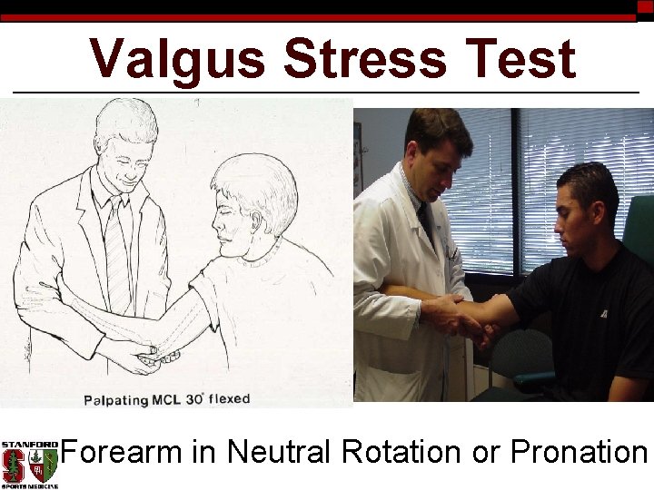 Valgus Stress Test Forearm in Neutral Rotation or Pronation 