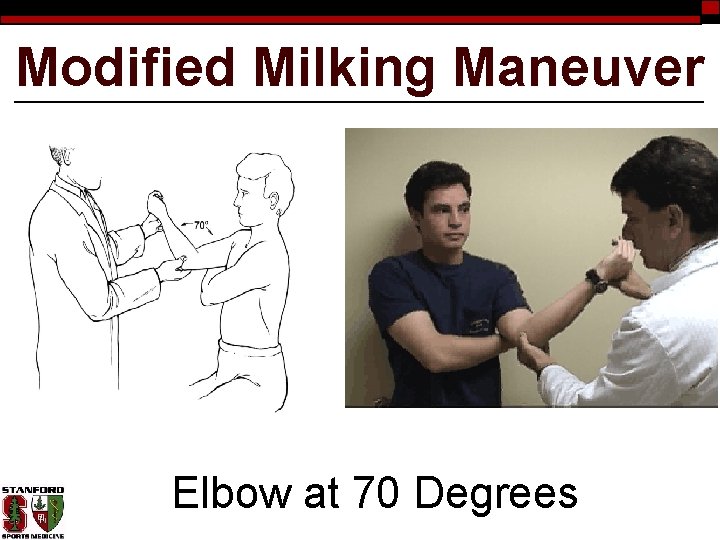 Modified Milking Maneuver Elbow at 70 Degrees 