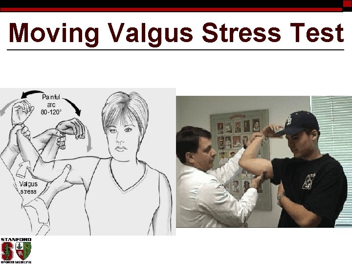 Moving Valgus Stress Test 