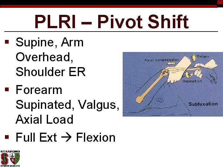 PLRI – Pivot Shift § Supine, Arm Overhead, Shoulder ER § Forearm Supinated, Valgus,