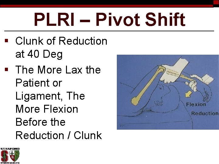 PLRI – Pivot Shift § Clunk of Reduction at 40 Deg § The More