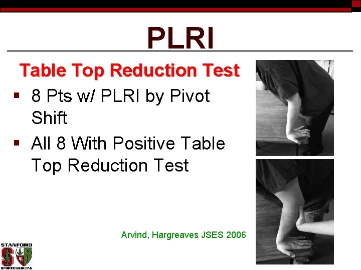 PLRI Table Top Reduction Test § 8 Pts w/ PLRI by Pivot Shift §