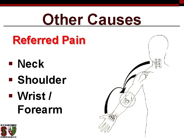 Other Causes Referred Pain § Neck § Shoulder § Wrist / Forearm 