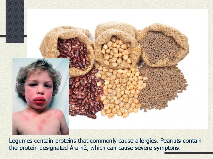 Legumes contain proteins that commonly cause allergies. Peanuts contain the protein designated Ara h