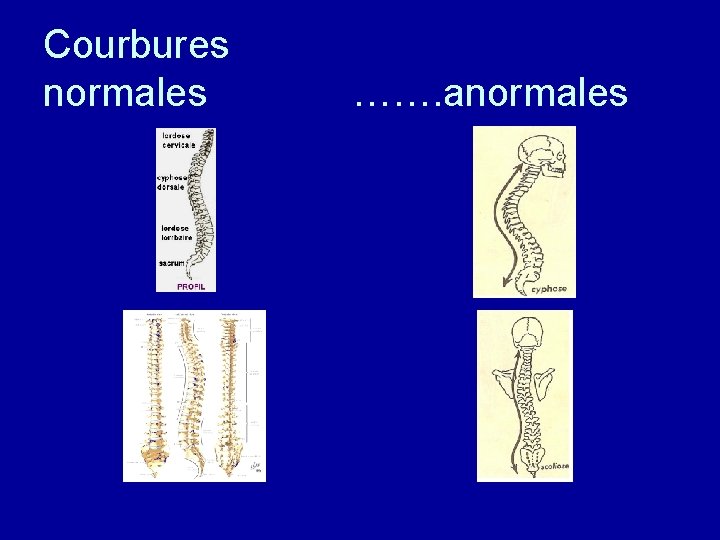 Courbures normales ……. anormales 