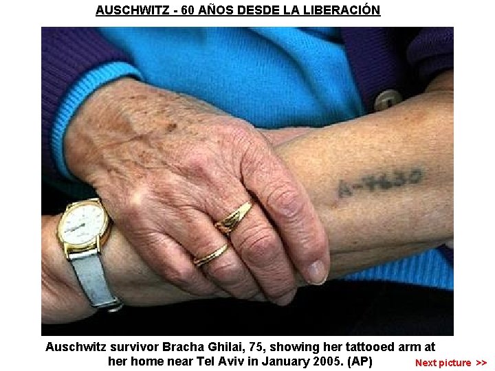 AUSCHWITZ - 60 AÑOS DESDE LA LIBERACIÓN Auschwitz survivor Bracha Ghilai, 75, showing her