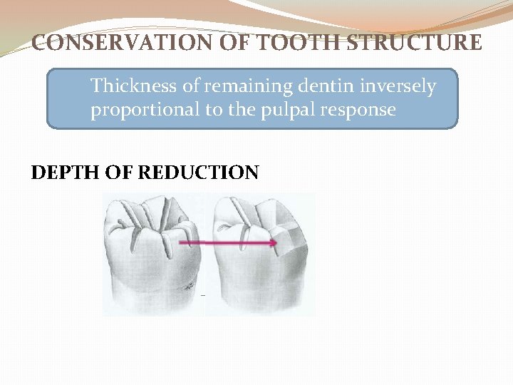 CONSERVATION OF TOOTH STRUCTURE Thickness of remaining dentin inversely proportional to the pulpal response